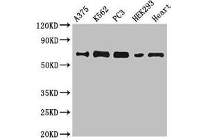 Western Blot Positive WB detected in: A375 whole cell lysate, K562 whole cell lysate, PC-3 whole cell lysate, HEK293 whole cell lysate, Mouse heart tissue All lanes: GBP2 antibody at 6. (GBP2 抗体  (AA 100-259))