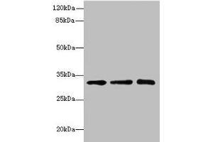 Western blot All lanes: RRAS2 antibody at 4. (SGCD 抗体  (AA 60-289))