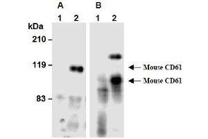 Western Blotting (WB) image for anti-Integrin beta 3 (ITGB3) antibody (ABIN1449278) (Integrin beta 3 抗体)