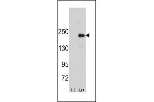 Western blot analysis of SG9 (arrow) using rabbit polyclonal SG9 Antibody (Center) (ABIN391447 and ABIN2841430). (SPAG9 抗体  (AA 603-632))