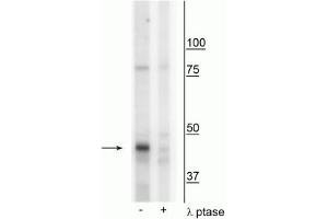 Western blot of mouse mitochondria from whole brain lysate showing specific immunolabeling of the ~46 kDa CK1Mt protein phosphorylated at Tyr153 in the first lane (-). (CKMT1A 抗体  (pTyr153))