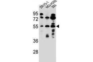 Western blot analysis of FUT6 Antibody (N-term) in ZR-75-1, NCI-H292, 293 cell line lysates (35ug/lane). (FUT6 抗体  (N-Term))