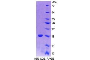 SDS-PAGE analysis of Mouse CALY Protein. (CALY 蛋白)