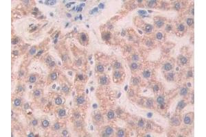 Detection of Slit1 in Rat Liver Tissue using Polyclonal Antibody to Slit Homolog 1 (Slit1)