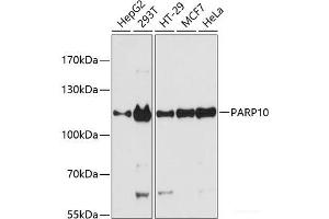 Western blot analysis of extracts of various cell lines using PARP10 Polyclonal Antibody at dilution of 1:3000. (PARP10 抗体)