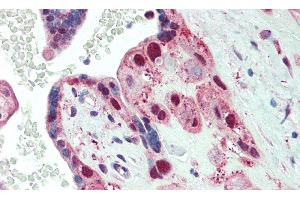 Detection of SPTbN4 in Human Placenta Tissue using Polyclonal Antibody to Spectrin Beta, Non Erythrocytic 4 (SPTbN4) (SPTBN4 抗体  (AA 64-285))