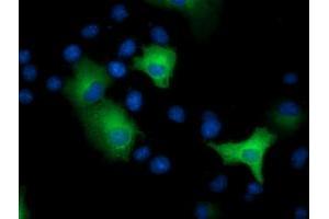 Anti-EPHX2 mouse monoclonal antibody (ABIN2452992) immunofluorescent staining of COS7 cells transiently transfected by pCMV6-ENTRY EPHX2 (RC202489). (EPHX2 抗体)