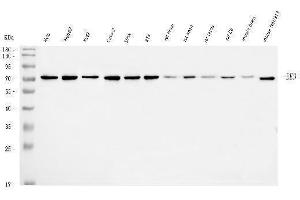 Western blot analysis of EED using anti-EED antibody (ABIN7602442).