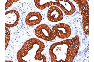 Image no. 5 for anti-Keratin 18 (KRT18) antibody (ABIN6179389) (Cytokeratin 18 抗体)