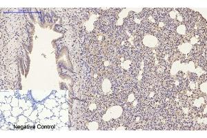 Immunohistochemical analysis of paraffin-embedded rat lung tissue. (Luciferase 抗体)