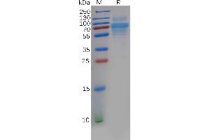 Human CA Protein, His Tag on SDS-PAGE under reducing condition.