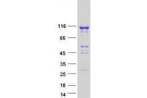 Western Blotting (WB) image for NLR Family, Pyrin Domain Containing 2 (NLRP2) protein (Myc-DYKDDDDK Tag) (ABIN2726786)