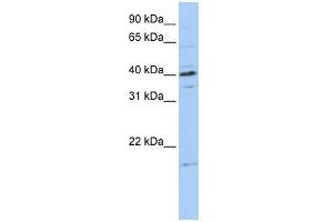 TPPP3 antibody used at 1 ug/ml to detect target protein. (TPPP3 抗体  (Middle Region))
