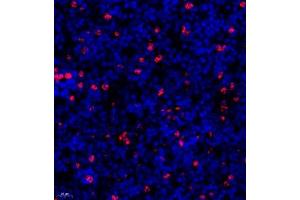Immunofluorescence (Paraffin-embedded Sections) (IF (p)) image for anti-Lymphocyte Antigen 6 Complex, Locus G (Ly6g) antibody (ABIN7074524)