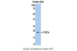 Western Blotting (WB) image for anti-CD46 (CD46) (AA 147-285) antibody (ABIN1174444) (CD46 抗体  (AA 147-285))