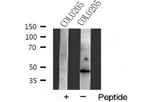 Western blot analysis of Actin γ2 expression in COLO205 cells (ACTG2 抗体  (N-Term))
