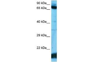 Host:  Rabbit  Target Name:  ZN182  Sample Type:  ACHN Whole Cell  Antibody Dilution:  1. (ZNF182 抗体  (C-Term))