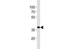 Western blot analysis of lysate from mouse stomach tissue lysate using Nkx2. (NK2 Homeobox 5 抗体  (AA 192-235))