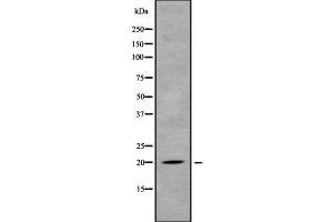 Western blot analysis of MED30 using MCF7 whole cell lysates (MED30 抗体  (Internal Region))