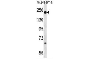 A2M Antibody (alpha 2 Macroglobulin 抗体  (N-Term))