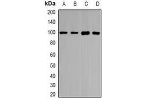 Western blot analysis of HIWI1 expression in HepG2 (A), SKOV3 (B), mouse testis (C), rat testis (D) whole cell lysates. (PIWIL1 抗体)