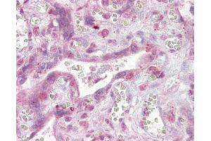 Anti-NFATC4 antibody IHC of human placenta. (NFATC4 抗体  (AA 953-965))