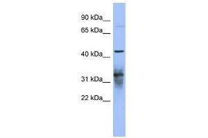 PABPC5 antibody used at 1 ug/ml to detect target protein. (PABPC5 抗体)