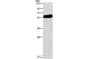 Western blot analysis of Human testis tissue, using APOH Polyclonal Antibody at dilution of 1:275 (APOH 抗体)