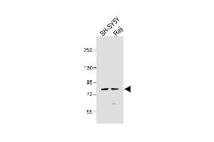 All lanes : Anti-K5 Antibody at 1:1000 dilution Lane 1: SH-SY5Y whole cell lysate Lane 2: Raji whole cell lysate Lysates/proteins at 20 μg per lane. (PAK7 抗体  (AA 168-198))