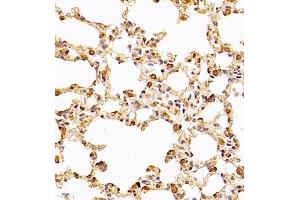 Immunohistochemistry (Paraffin-embedded Sections) (IHC (p)) image for anti-Chloride Intracellular Channel 6 (CLIC6) antibody (ABIN7073478)