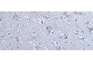 Immunohistochemistry of paraffin-embedded Human brain tissue using ZNF703 Polyclonal Antibody at dilution of 1:55(x200) (ZNF703 抗体)