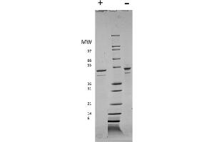 SDS-PAGE of Human Visfatin Recombinant Protein SDS-PAGE of Human Visfatin Recombinant Protein. (NAMPT 蛋白)