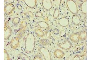 Immunohistochemistry of paraffin-embedded human kidney tissue using ABIN7145213 at dilution of 1:100 (BAG2 抗体  (AA 1-211))