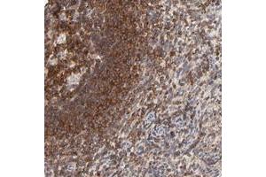 Immunohistochemical staining of human spleen with WIPF1 polyclonal antibody  shows strong cytoplasmic positivity in cells in red pulp and cells in white pulp.