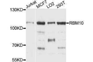 Western blot analysis of extracts of various cell lines, using RBM10 antibody (ABIN1874563) at 1:1000 dilution. (RBM10 抗体)