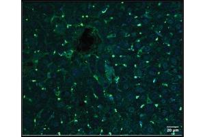 Biodistribution of ASO. (ModDetect® 2'-O-Methoxyethyl (2'MOE) Panel)
