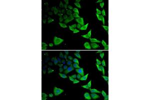 Immunofluorescence analysis of MCF-7 cells using SNCA antibody. (SNCA 抗体  (AA 61-140))