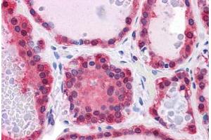 Human Thyroid: Formalin-Fixed, Paraffin-Embedded (FFPE) (LDHB 抗体  (AA 1-335))
