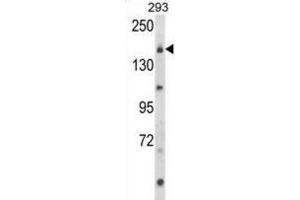 Western Blotting (WB) image for anti-Unc-13 Homolog B (UNC13B) antibody (ABIN3003956) (UNC13B 抗体)