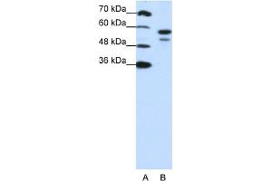 WB Suggested Anti-U2AF2 Antibody Titration:  1. (U2AF2 抗体  (N-Term))