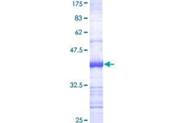 ADAM17 Protein (AA 215-314) (GST tag)