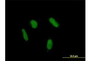 Immunofluorescence of purified MaxPab antibody to ZNF436 on HepG2 cell. (ZNF436 抗体  (AA 1-470))