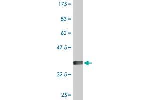 Western Blot detection against Immunogen (36. (ODF2 抗体  (AA 706-804))