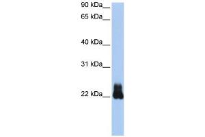 WB Suggested Anti-RHOD Antibody Titration:  0. (RHOD 抗体  (N-Term))