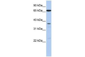 WB Suggested Anti-ABCB9 Antibody Titration:  0. (ABCB9 抗体  (N-Term))