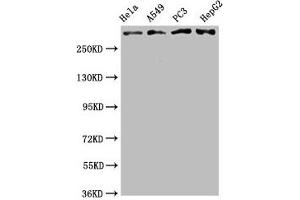 Western Blot Positive WB detected in: Hela whole cell lysate, A549 whole cell lysate, PC3 whole cell lysate, HepG2 whole cell lysate All lanes: ATM antibody at 2. (Recombinant ATM 抗体)