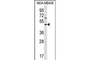 Western blot analysis in MDA-MB435 cell line lysates (35ug/lane). (KERA 抗体  (C-Term))