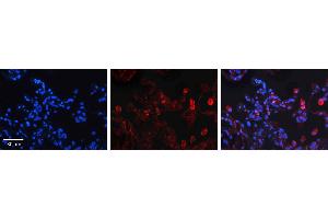 Immunohistochemistry (IHC) image for anti-Sphingolipid Delta(4)-Desaturase DES1 (DEGS1) (N-Term) antibody (ABIN405745) (DEGS1 抗体  (N-Term))