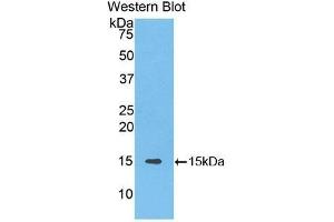 Western Blotting (WB) image for anti-Solute Carrier Family 30 (Zinc Transporter), Member 8 (SLC30A8) (AA 263-369) antibody (ABIN1176292) (SLC30A8 抗体  (AA 263-369))