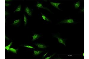 Immunofluorescence of purified MaxPab antibody to CSDA on HeLa cell. (CSDA 抗体  (AA 1-372))